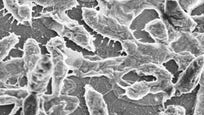 Experts say the type of bacteria eating away at a Georgia grad student is extremely rare.